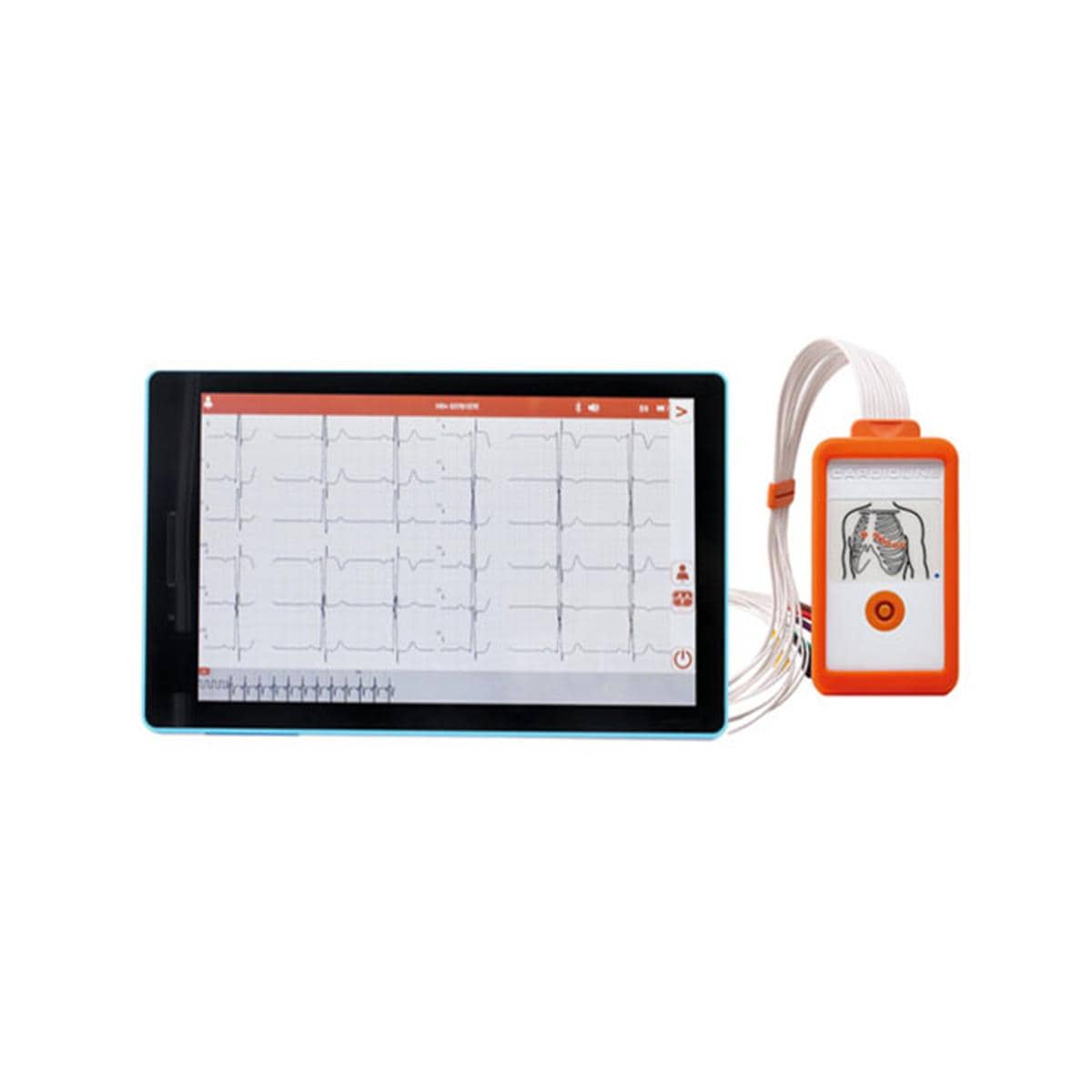 ELECTROCARDIÓGRAFO TOUCHECG ANDROID 1U