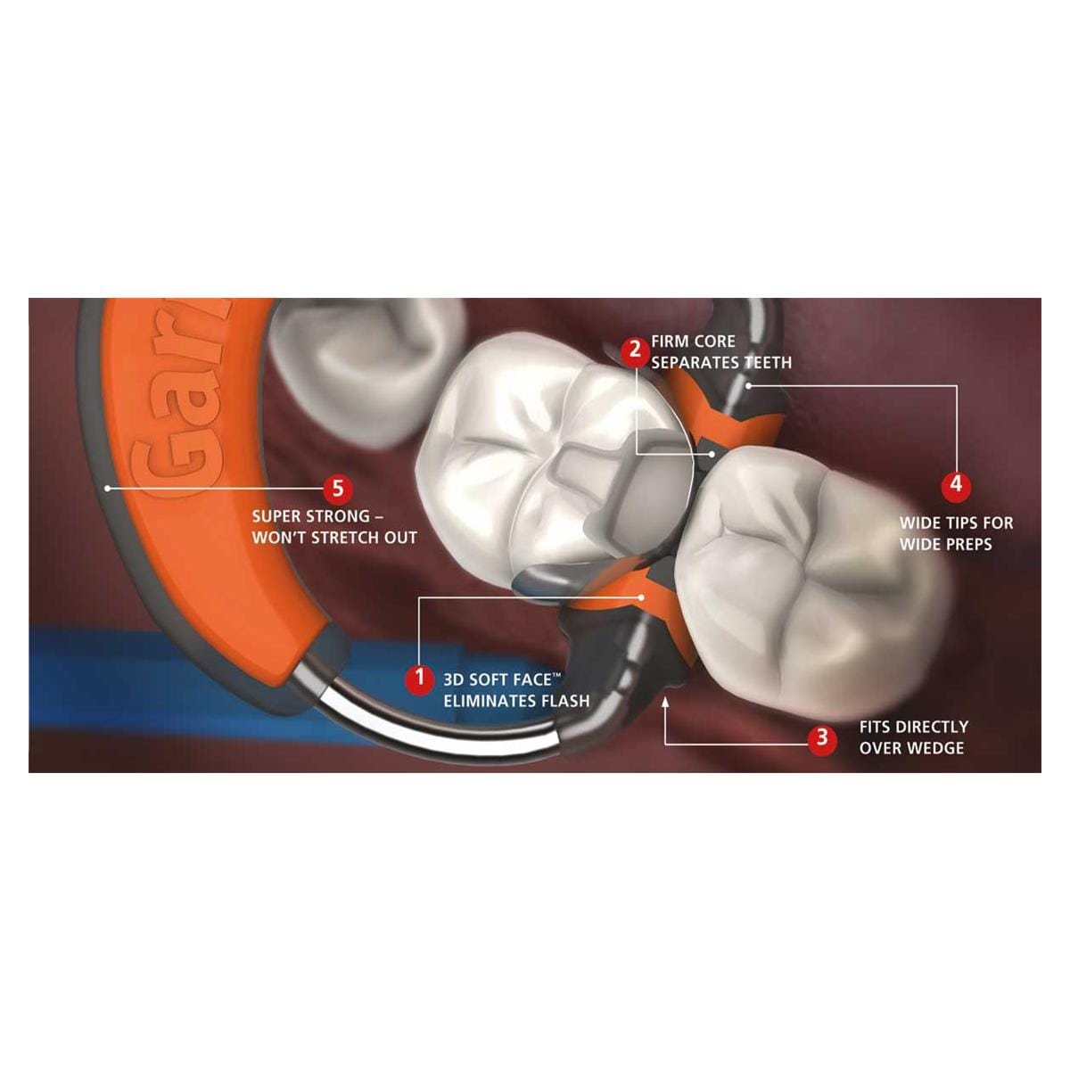 COMPOSI-TIGHT 3D KIT 3DKM00 - GARRISON