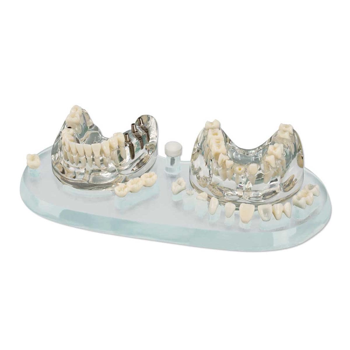 MODELO DENTAL DE IMPLANTES - HAGER WERKEN