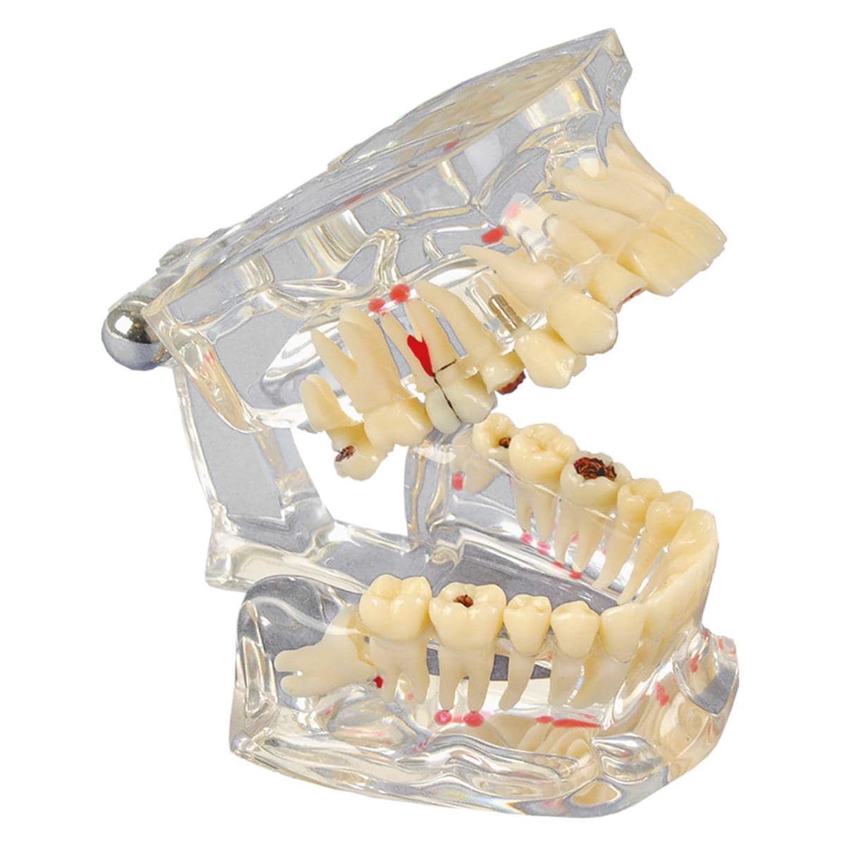 MODELO DENTAL TRANSPARENTE DE LUJO 1U - HAGER & WERKEN