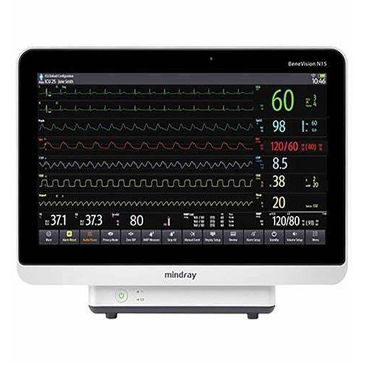 MONITOR MULTIP.ANESTESIA N15 /BIS/NMT/SPO2 MINDRAY